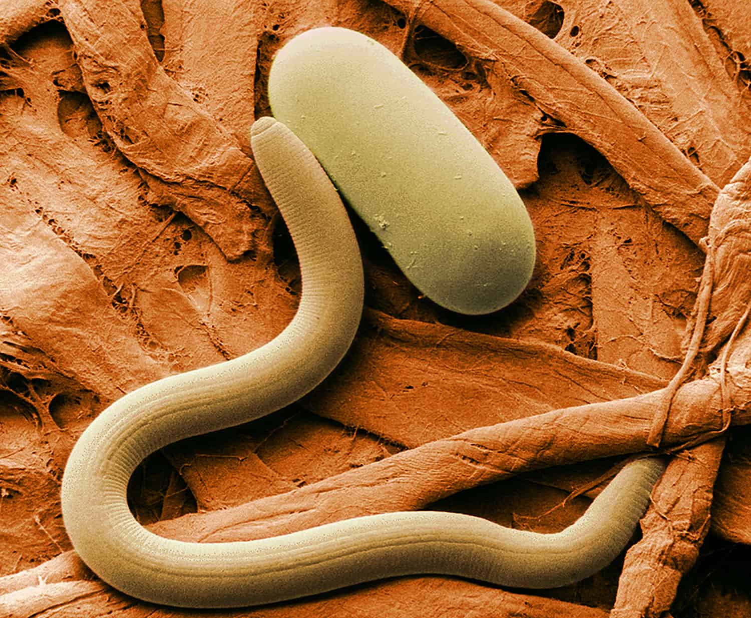 What Are Nematodes? These Tiny Worms Can Help or Hurt Your Garden